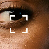 Eye Bags + Dark Circles