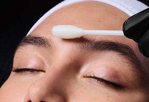 Deep Chemical Peel Banner