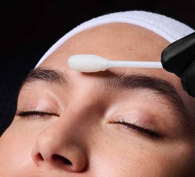 Deep Chemical Peel Hero Banner