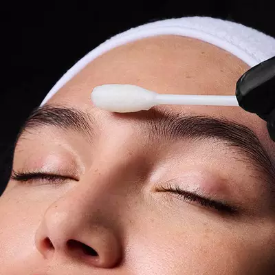 Deep Chemical Peel Hero Banner