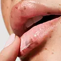 Lip Care