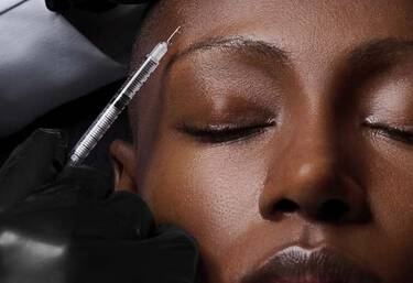 Adult Acne + Scarring