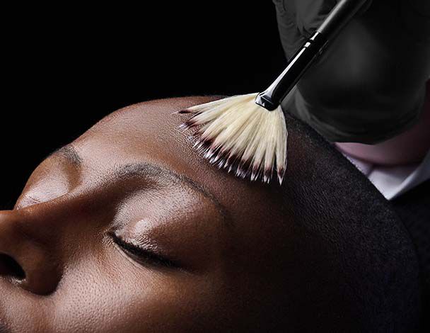 Light Chemical Peel Banner