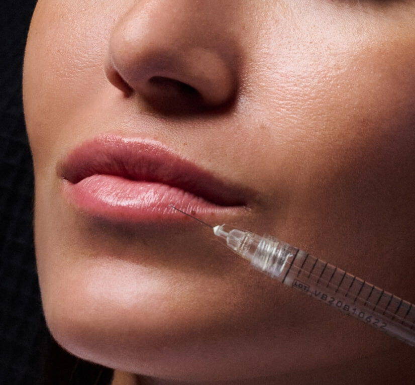 Dermal Fillers maintenance