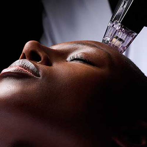 RF Microneedling Image