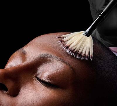 Medium Chemical Peel Hero Banner