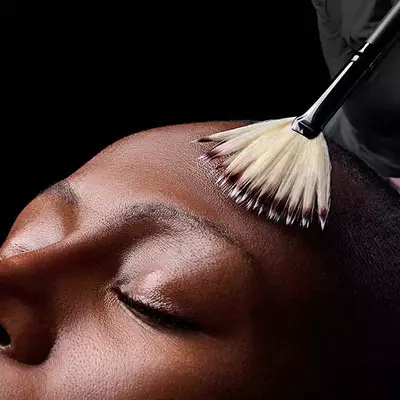 Medium Chemical Peel Hero Banner