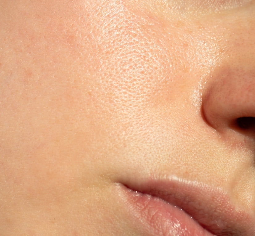 How to prevent and minimize pores
