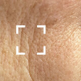 Fine Lines + Wrinkles