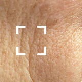 Fine Lines + Wrinkles