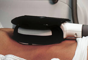 EmSculpt Body Image