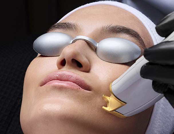 Non-Ablative Laser Banner