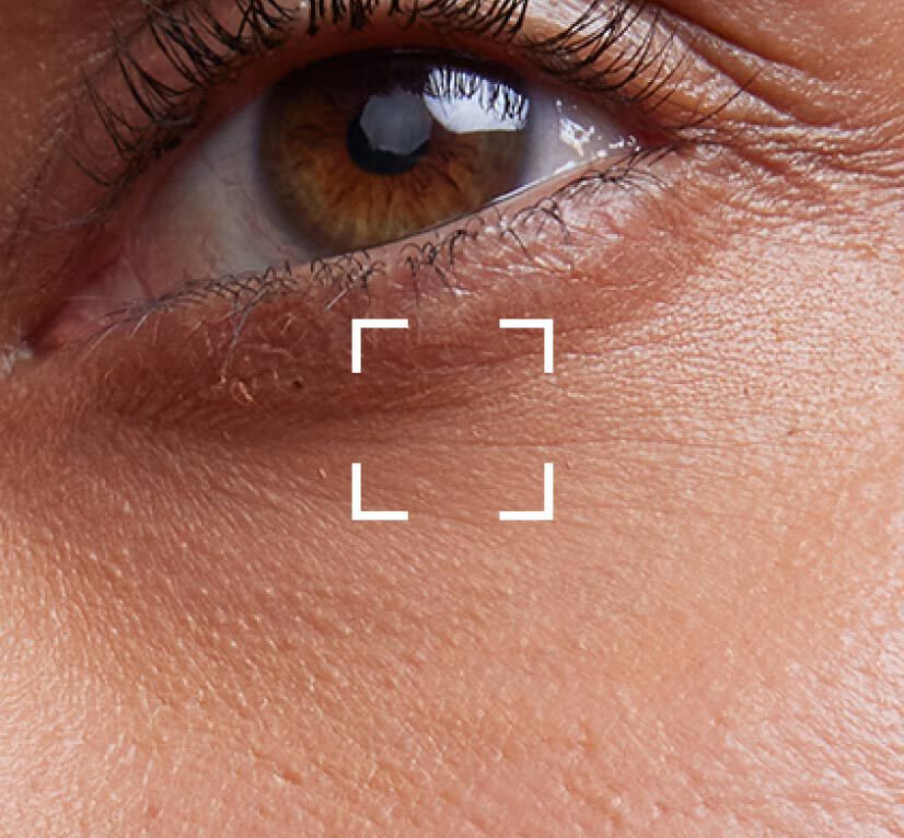 Corrective moisturizers