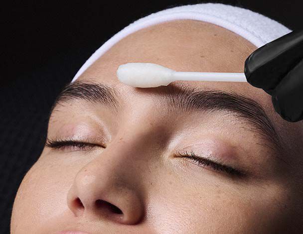 Deep Chemical Peel Banner