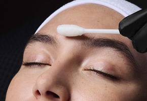 Deep Chemical Peel Banner