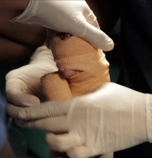 Burn Awareness Week Image 2