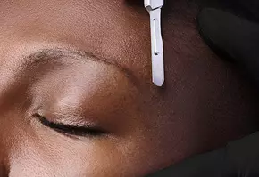 Dermaplaning Banner