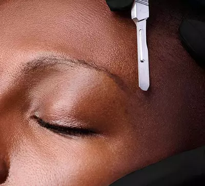 Dermaplaning Hero Banner
