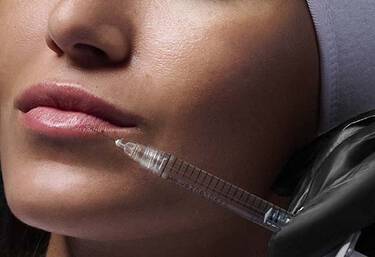 Adult Acne + Scarring