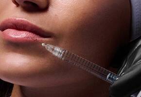 Injectable Hyaluronic Acid Filler Banner