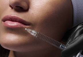 Injectable Hyaluronic Acid Filler