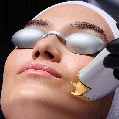 non ablative laser