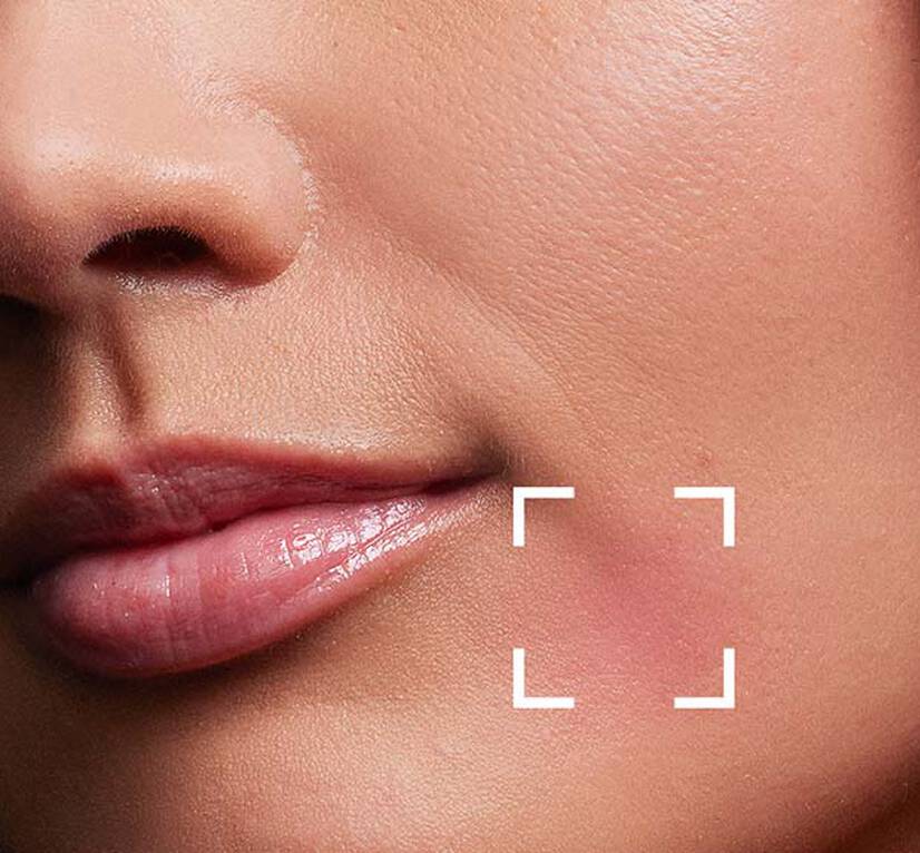 Corrective moisturizers