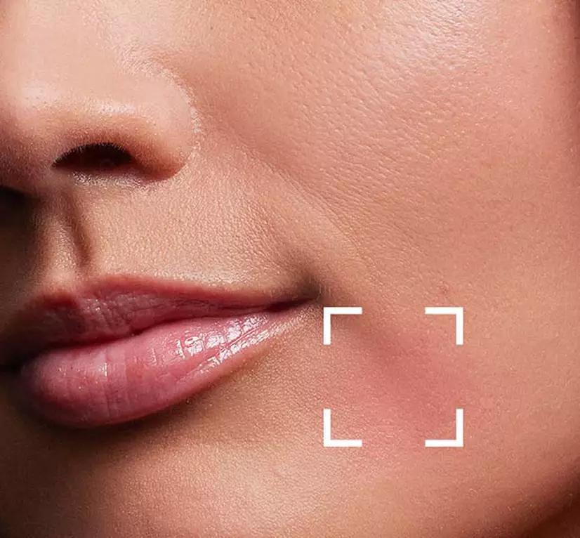 Corrective moisturizers