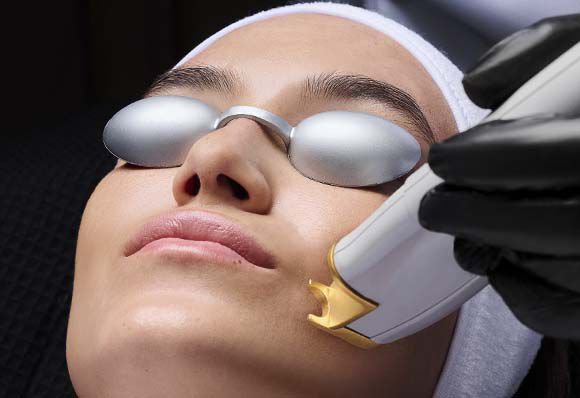 Adult Acne + Scarring