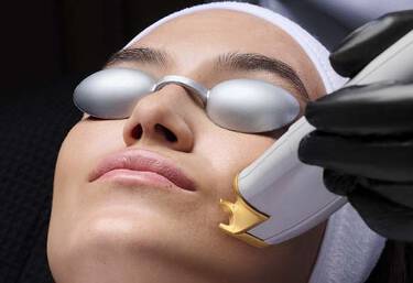 Adult Acne + Scarring